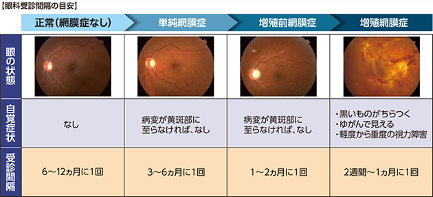 眼科受信感覚の目安
