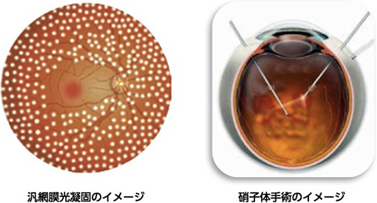 眼科受信感覚の目安