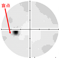 正常視野